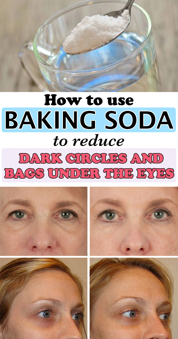 Getting rid of dark circles is not easy, but if you use baking soda, you'll get fresh looking rested eyes and the plus point is that it also removes swelling. Must See!